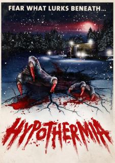 Гипотермия    / Hypothermia